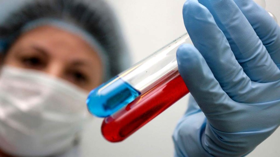Vspyishku-tuberkuleza-na-Ukraine-svyazali-s-postroennyimi-na-dengi-SSHA-laboratoriyami.jpg